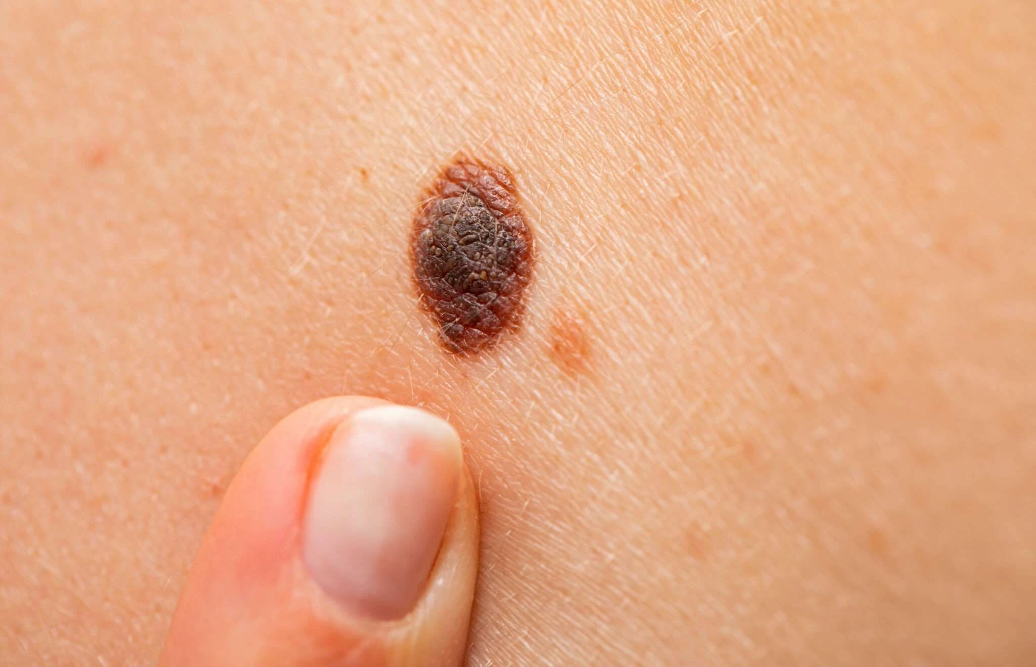 skin health conversations